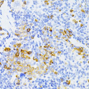 Immunohistochemistry - MMP2 antibody (144-06247)