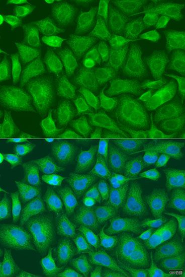 Immunofluorescence - BAG2 Polyclonal Antibody (144-07763)
