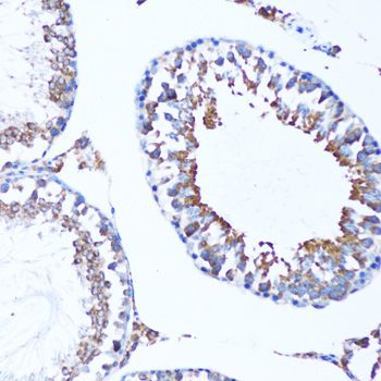 Immunohistochemistry - MAP1LC3A antibody (144-011438)