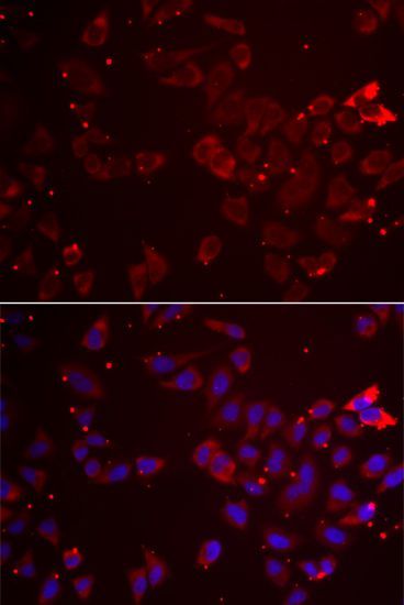 Immunohistochemistry - GATM Polyclonal Antibody (144-06598)