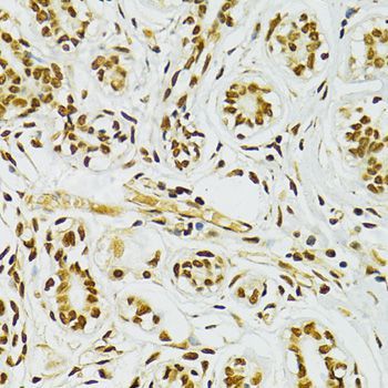 Immunohistochemistry - ADAR Polyclonal Antibody (144-07869)