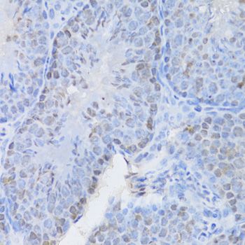 Immunohistochemistry - CBX8 Polyclonal Antibody (144-06222)