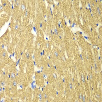 Immunohistochemistry - TPM3 antibody (144-013557)
