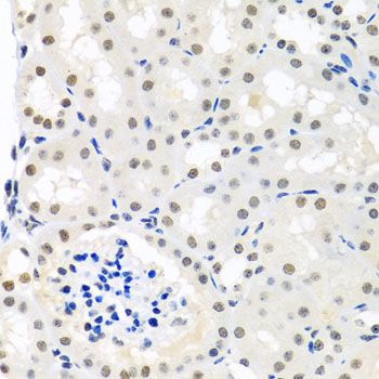 Immunohistochemistry - THOC1 antibody (144-08179)