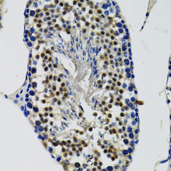 Immunohistochemistry - DDX41 Polyclonal Antibody (144-06576)