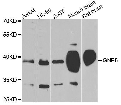 Western blot - GNB5 antibody (144-04447)