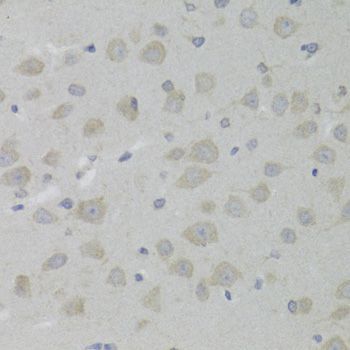 Immunohistochemistry - HSD17B13 Antibody (144-06256)