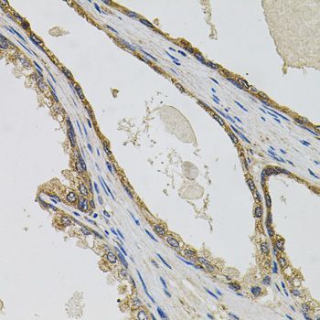 Immunohistochemistry - PTK7 antibody (144-09839)