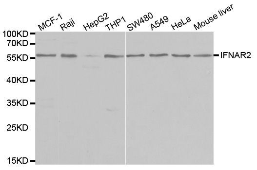 Western blot - IFNAR2 Polyclonal Antibody (144-01769)