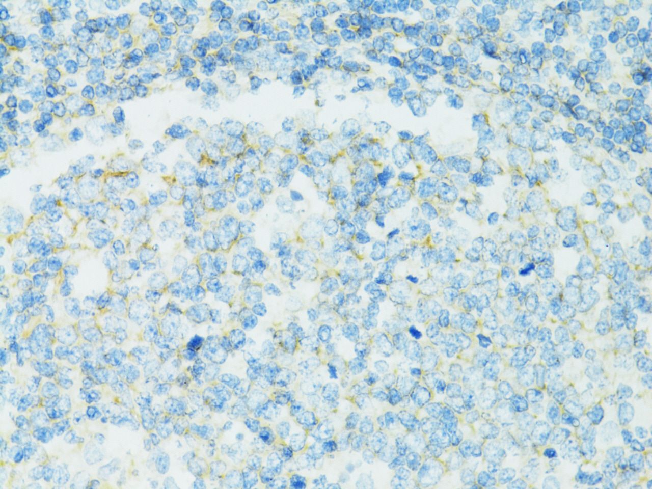 Immunohistochemistry - CD19 antibody (144-02577)