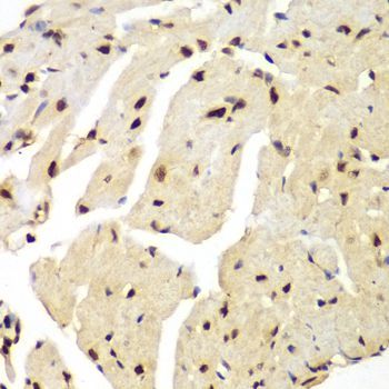 Immunohistochemistry - LIG3 antibody (144-60365)