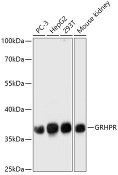 Western blot
