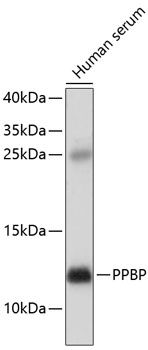 Western blot
