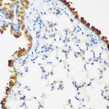 Immunohistochemistry - LRP5 Polyclonal Antibody (144-00130)