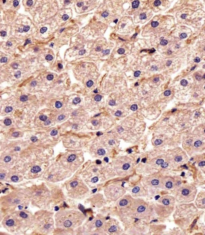 IHC-P