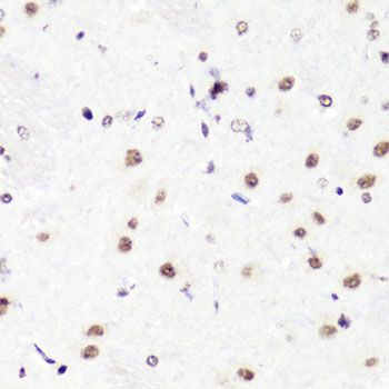 Immunohistochemistry - Asymmetric DiMethyl-Histone H3-R2 pAb (144-03155)