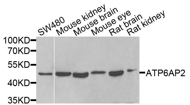 Western blot - ATP6AP2 antibody (144-06531)