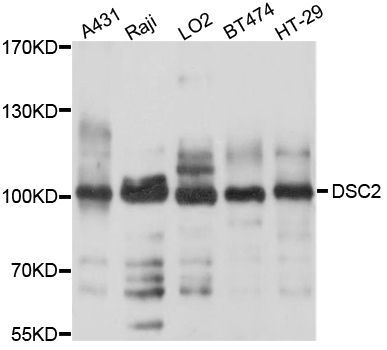 Western blot - DSC2 Polyclonal Antibody (144-010211)