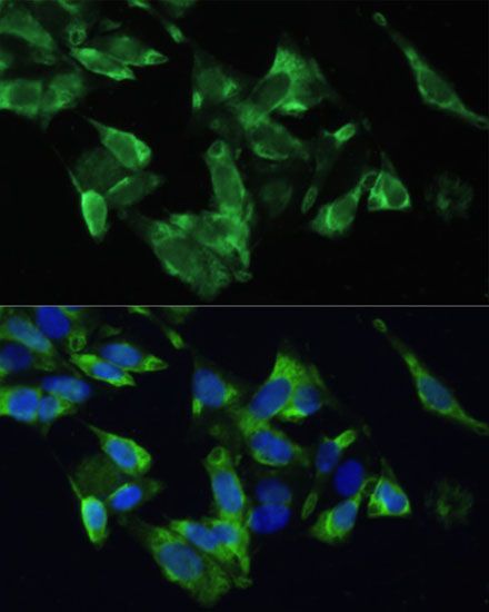 Immunofluorescence - PMEPA1 antibody (144-012171)