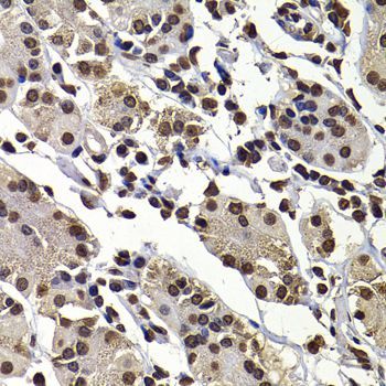 Immunohistochemistry - DNAJB6 Polyclonal Antibody (144-07052)