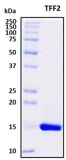 SDS-PAGE