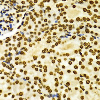 Immunohistochemistry - DiMethyl-Histone H3-K27 pAb (144-02362)