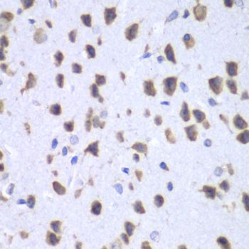 Immunohistochemistry - UPF1 antibody (144-013541)