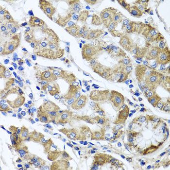 Immunohistochemistry - ETFA antibody (144-07670)