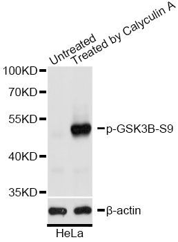 Western blot - Phospho-GSK3B-S9 pAb (144-50039)