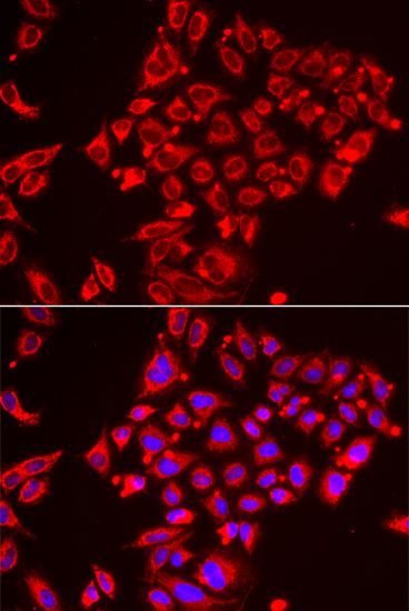 Immunofluorescence - ST3GAL3 antibody (144-06753)
