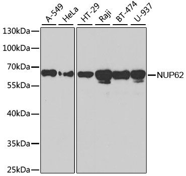 Western blot - NUP62 antibody (144-02499)