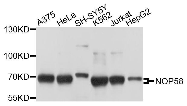 Western blot - NOP58 Polyclonal Antibody (144-04749)