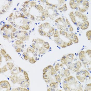 Immunohistochemistry - [KO Validated] PPP1CC Polyclonal Antibody (144-04035)