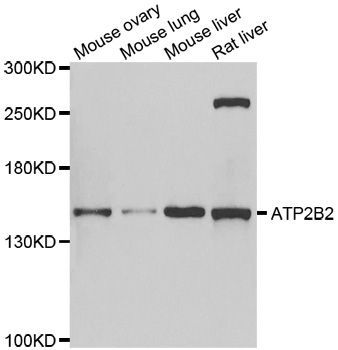 Western blot - ATP2B2 antibody (144-06875)