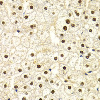 Immunohistochemistry - DDB1 Polyclonal Antibody (144-02896)