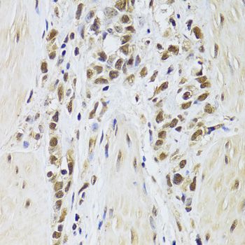 Immunohistochemistry - SF1 Antibody (144-06424)