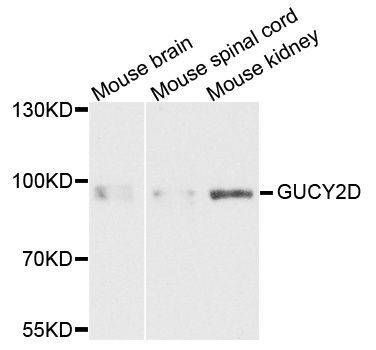 Western blot - GUCY2D antibody (144-03605)