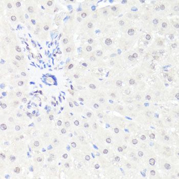Immunohistochemistry - EGFR Polyclonal Antibody (144-011577)