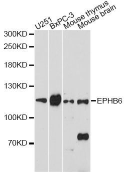 Western blot - EPHB6 antibody (144-60766)