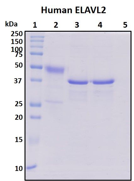 SDS-PAGE