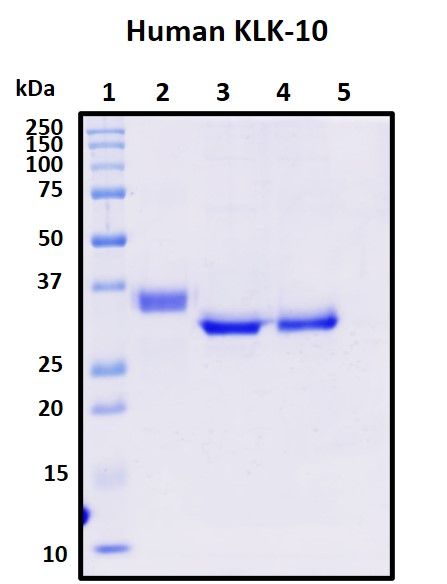 SDS-PAGE