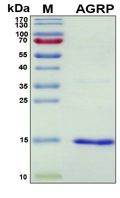 SDS-PAGE