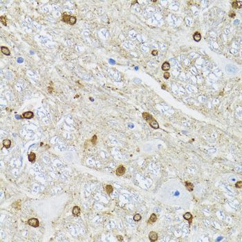 Immunohistochemistry - TPPP antibody (144-08574)