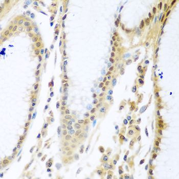 Immunohistochemistry - MYBBP1A Polyclonal Antibody (144-04429)