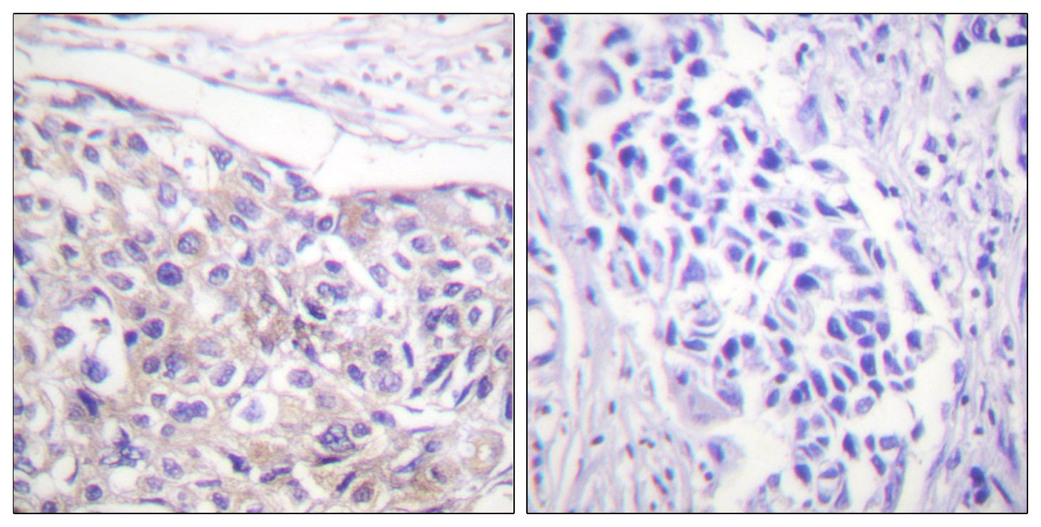 IHC