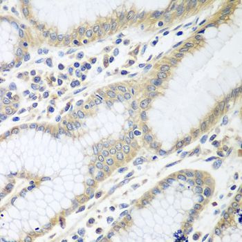 Immunohistochemistry - RPN2 antibody (144-08352)