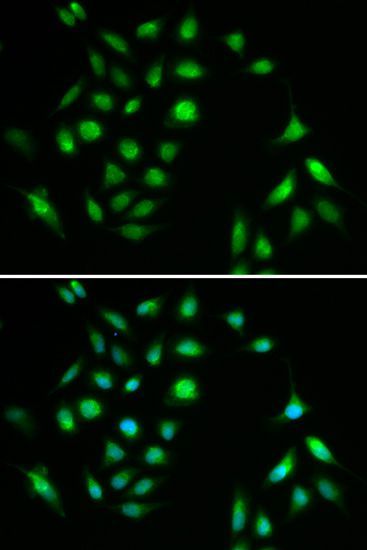 Immunofluorescence - CHUK Polyclonal Antibody (144-02062)