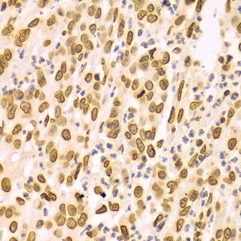Immunohistochemistry - Lamin A/C Polyclonal Antibody (144-00249)