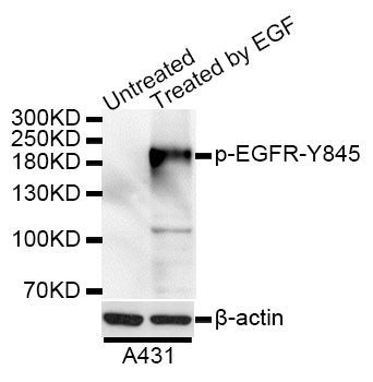 Western blot - Phospho-EGFR-Y845 antibody (144-50023)