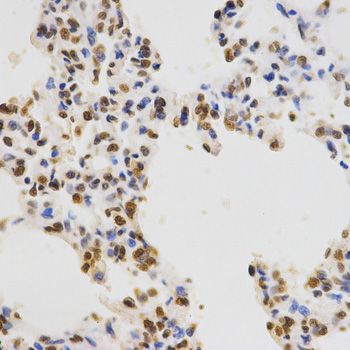 Immunohistochemistry - TriMethyl-Histone H3-K36 pAb (144-02366)